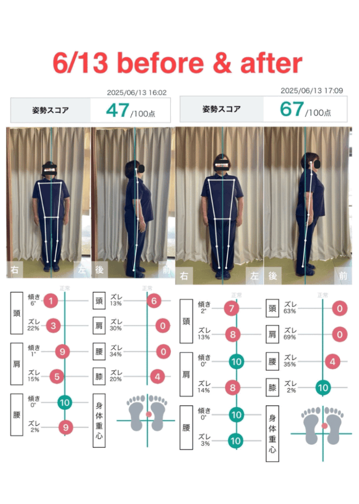 整体姿勢改善